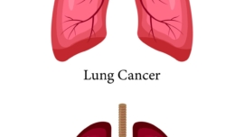 Lung Cancer
