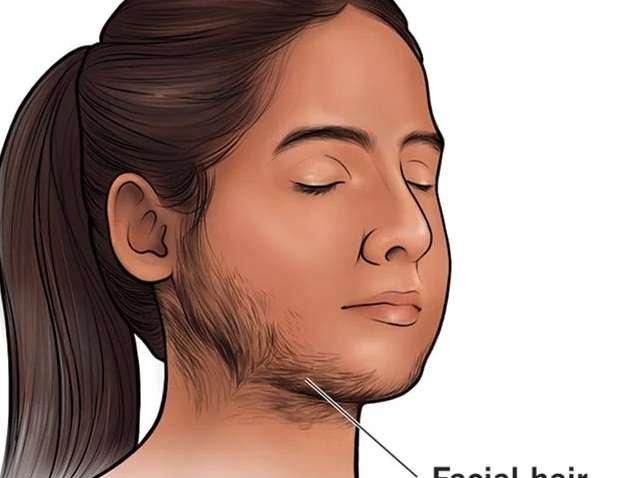 Facial and Stomach Hair